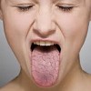 What is dry mouth?